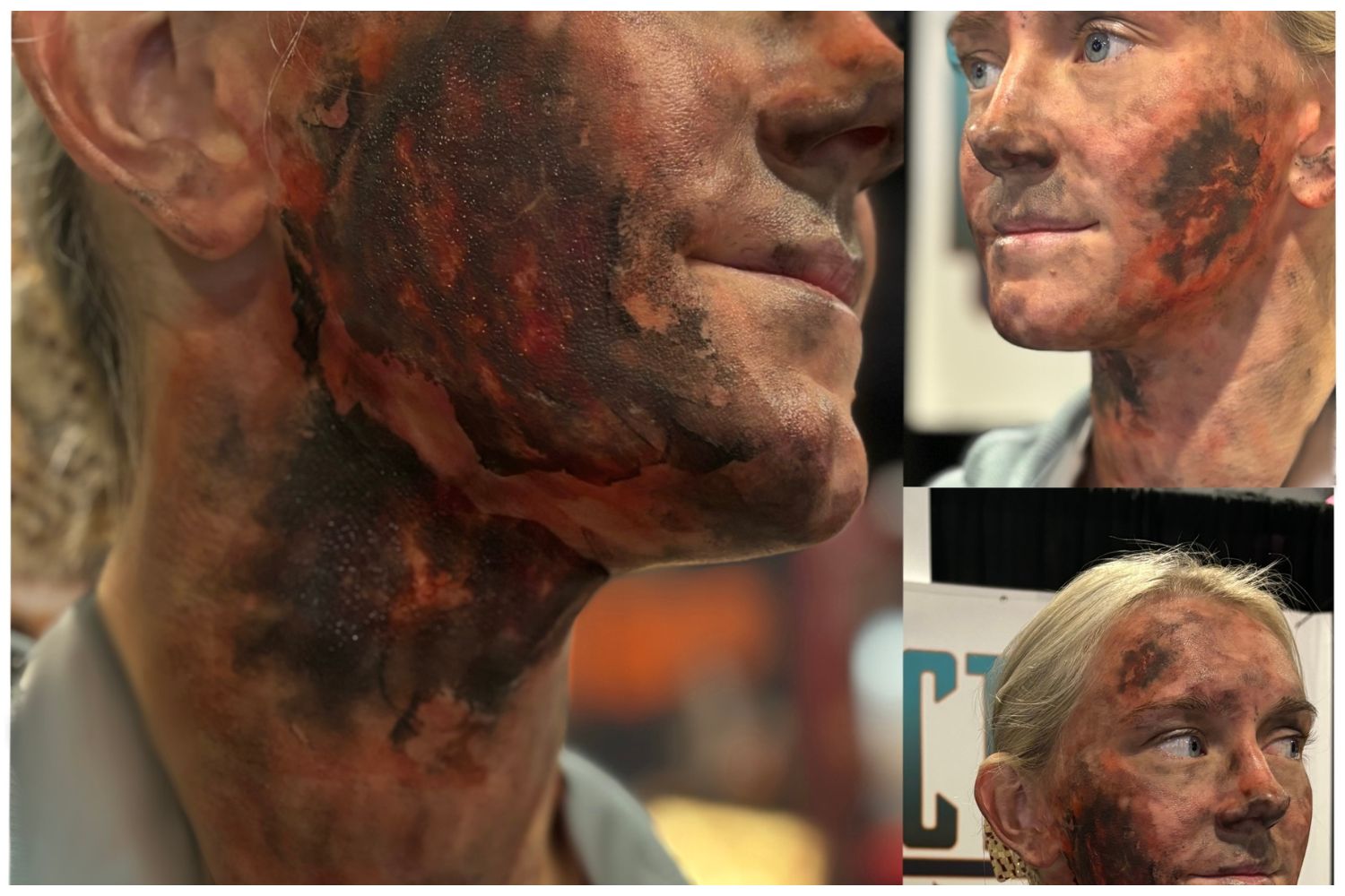 Third-Degree Burn Temporary Tattoos