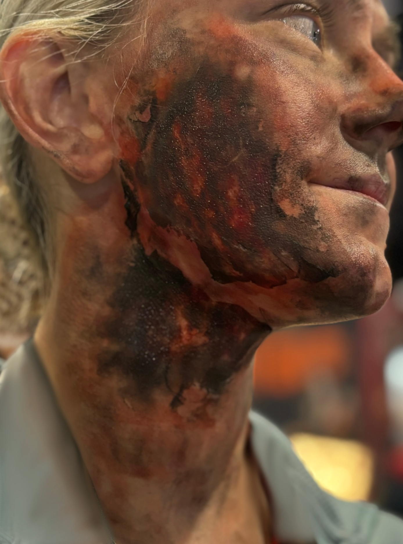 Third-Degree Burn Temporary Tattoos