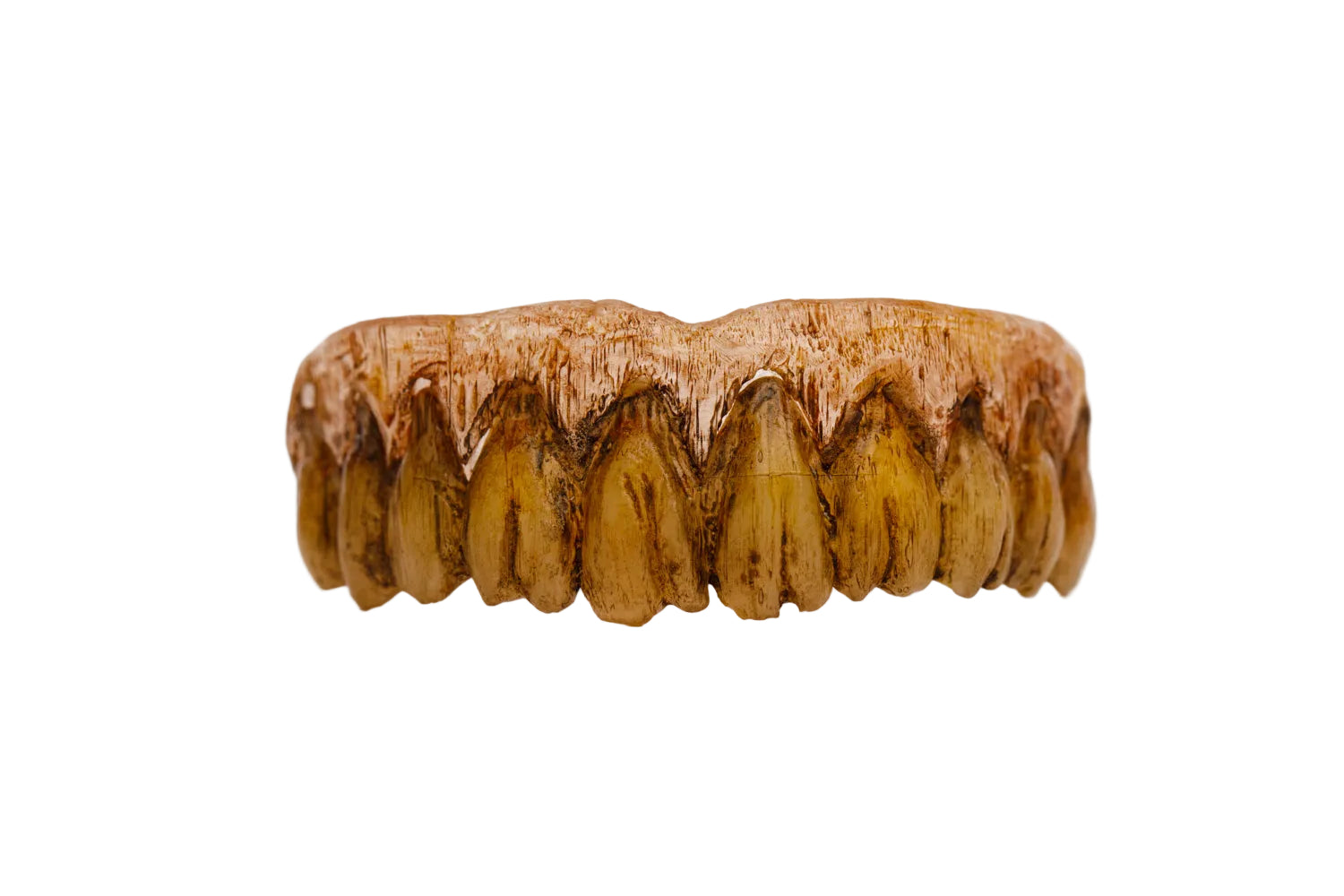 Rotten zombie character teeth prosthetic with heavy decay and Comfort Fit system